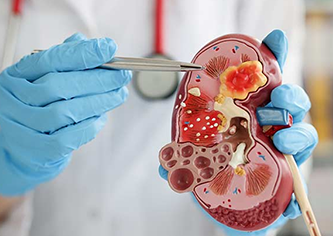 IUI Treatment Specialist in Pune